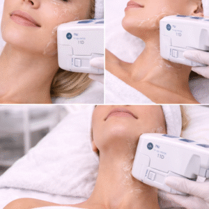 Face + Jawline + Neck